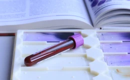 Сладкий кошмар: врач назвала первые признаки сахарного диабета у взрослых и детей