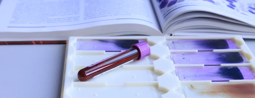 Крапивница