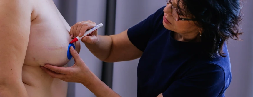 Реконструкция соска