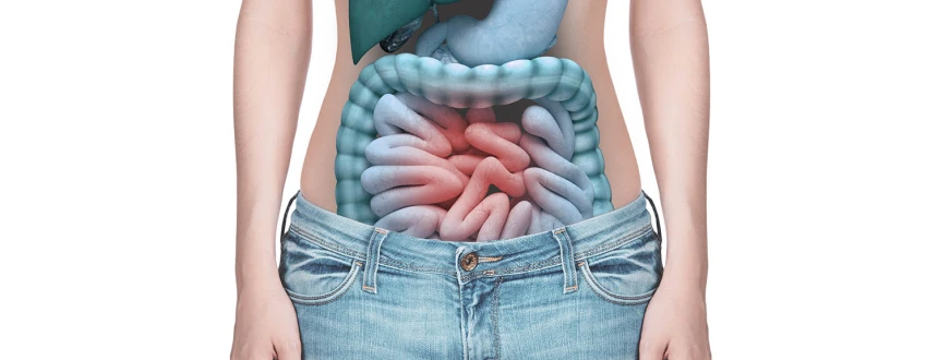 Колостомия